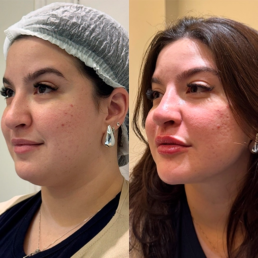 ANTES E DEPOIS 7 - DR DIOGO